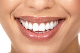 Dental Whitestrips - forum - Amazon - krém
