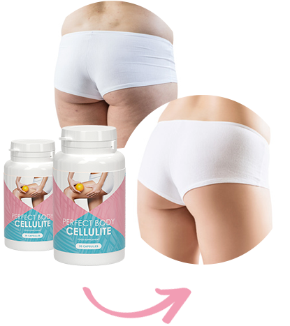 Perfect Body Cellulite - zda webu výrobce - kde koupit - heureka - v lékárně - dr max