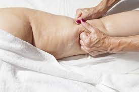 Cellulite Massage - recenze - diskuze - forum - výsledky