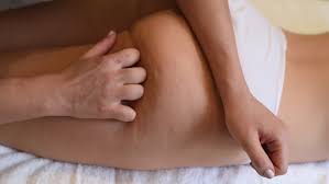 Cellulite Massage - zkušenosti - dávkování - složení - jak to funguje